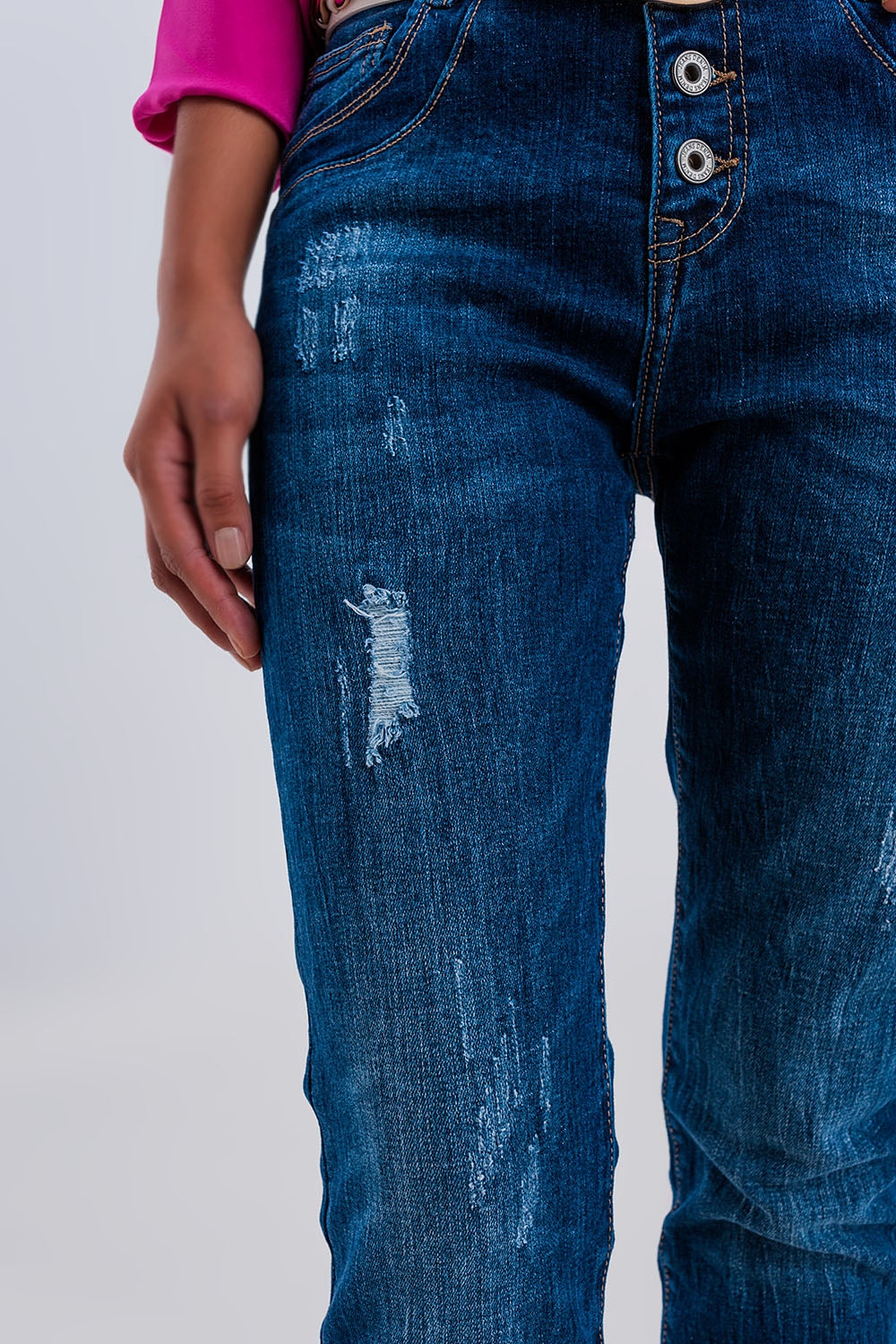 Vaqueros boyfriend azul oscuro rasgados con botones expuestos Q2